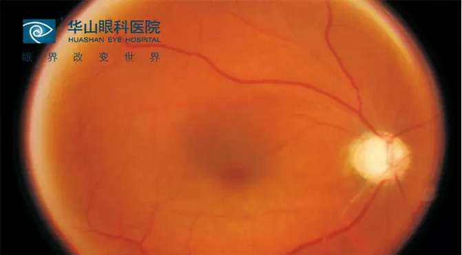 新音初起：抗青光眼新药进入中国临床